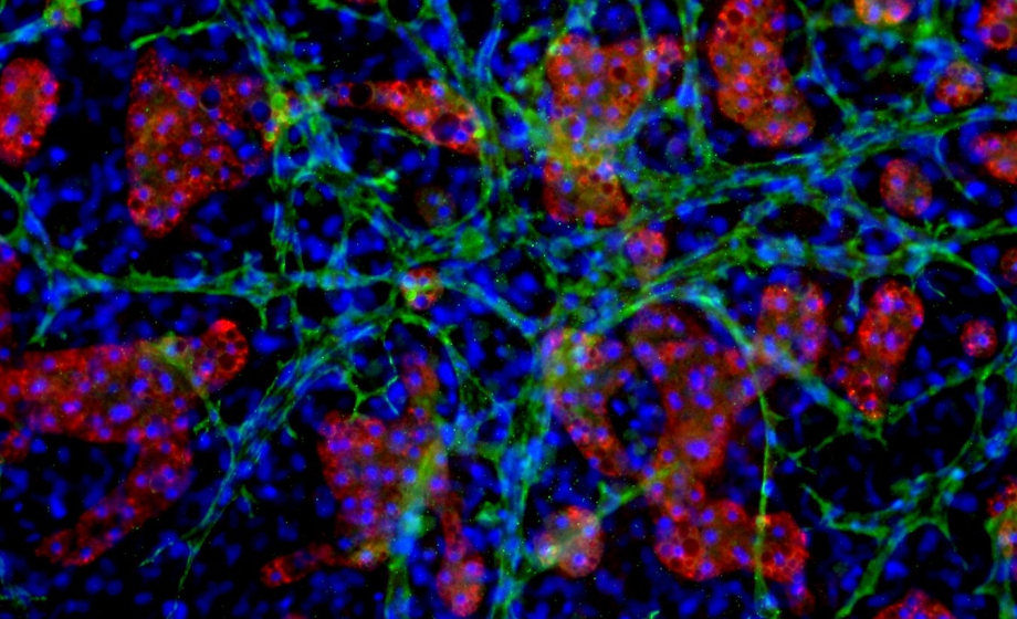 A Novel, All-Human Hepatic Tri-Culture Model