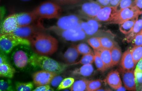 Visualizing the Intracellular Immune Response to SARS-CoV-2 with Fast, High-Content Imaging