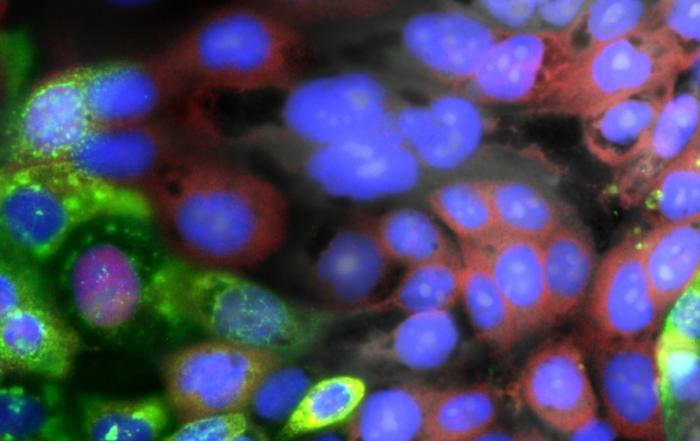 Visualizing the Intracellular Immune Response to SARS-CoV-2 with Fast, High-Content Imaging