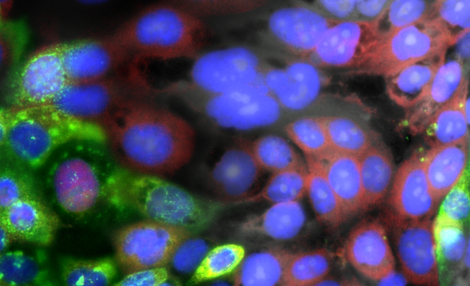 Visualizing the Intracellular Immune Response to SARS-CoV-2 with Fast, High-Content Imaging