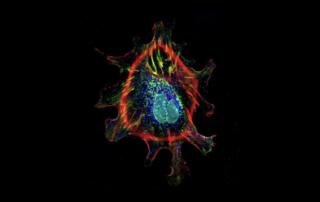 Cell Painting