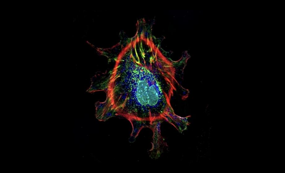Cell Painting