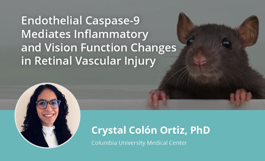 Endothelial Caspase-9 Mediates Inflammatory and Vision Function Changes in Retinal Vascular Injury