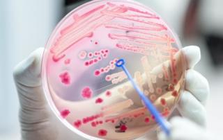 Novel Therapies for UTIs FI