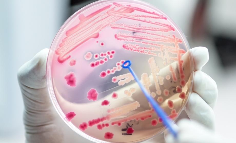 Novel Therapies for UTIs FI