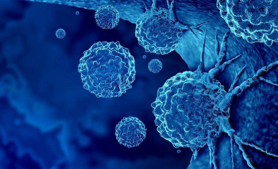 Cancer cells