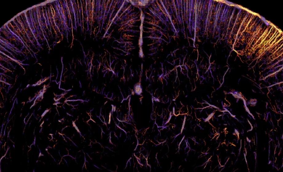 Functional Ultrasound Neuroimaging