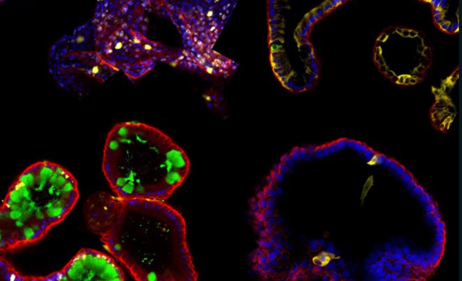 Intestinal Toxicity Assessment with Patient-Derived Organoids