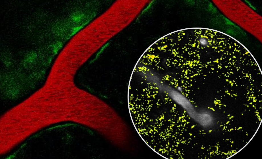 Neurovascular Coupling-Novel Insights from Studies in Awake Head-Fixed and Anesthetized Mice