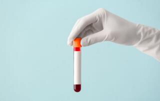 Brain-Derived Tau in Blood for Alzheimer's Disease Diagnosis FI