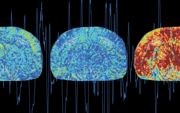Multimodal Neuroimaging Using Functional Ultrasound (fUS)