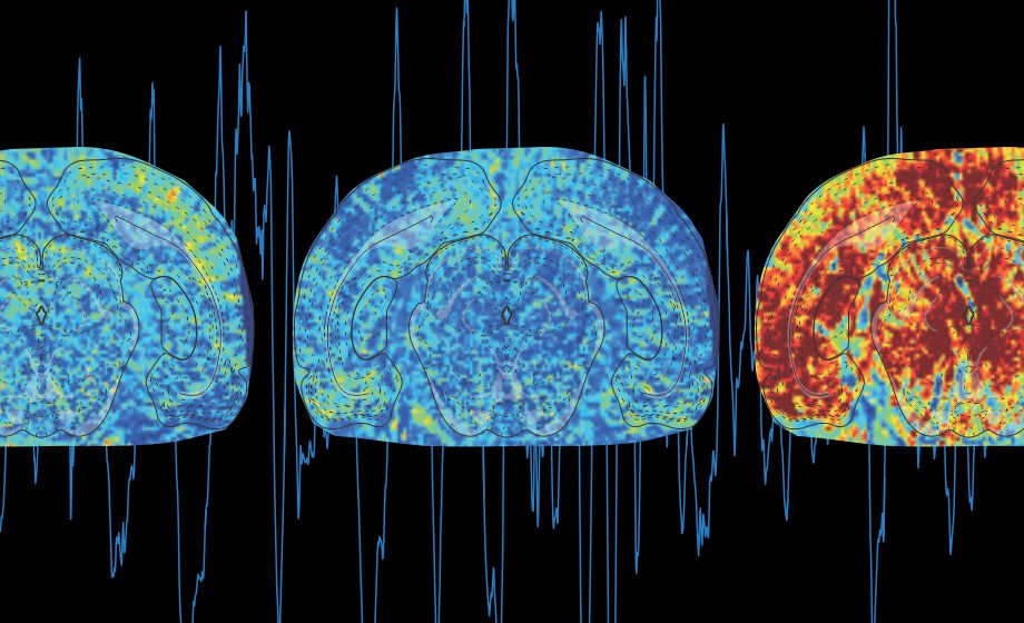 Multimodal Neuroimaging Using Functional Ultrasound (fUS)