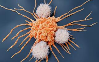White blood cells attack tumor.