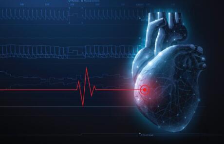 Peripheral and Cerebral Vascular Responses Following High-Intensity Interval Exercise