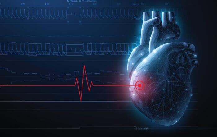 Peripheral and Cerebral Vascular Responses Following High-Intensity Interval Exercise