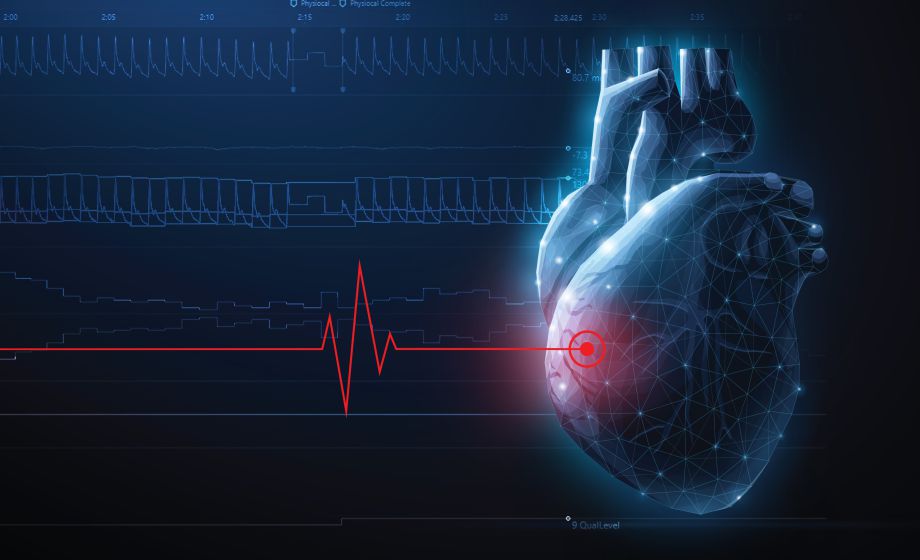 Peripheral and Cerebral Vascular Responses Following High-Intensity Interval Exercise