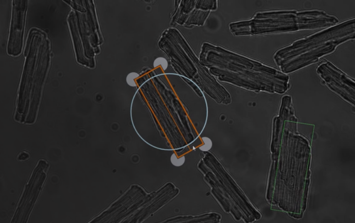 IonOptix: Revolutionizing Cardiovascular Research through Customer-Driven Innovation