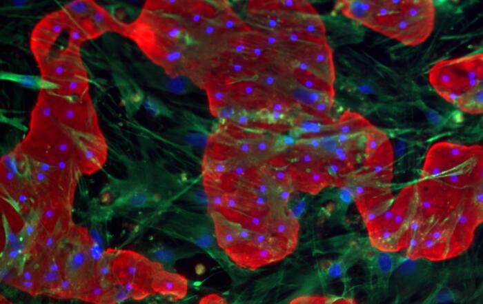 Evaluation of TruVivo, an All-Human Hepatocyte Model for Mechanistic DMPK Investigations