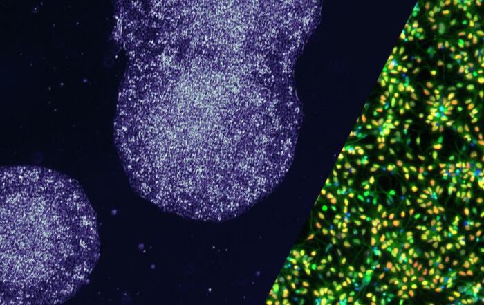 Fully Characterized, Standardized Human Induced Pluripotent Stem Cell Line and Ready-to-Use, High-Quality Neural Progenitor Cells for Downstream Differentiation Applications