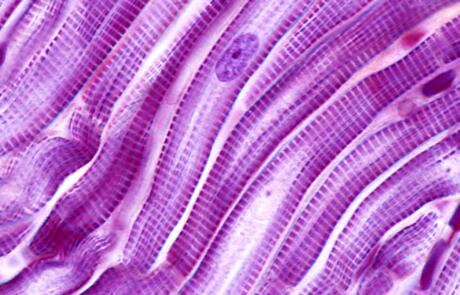 Cut and Paste of Myosin Binding Protein-C in Striated Muscles