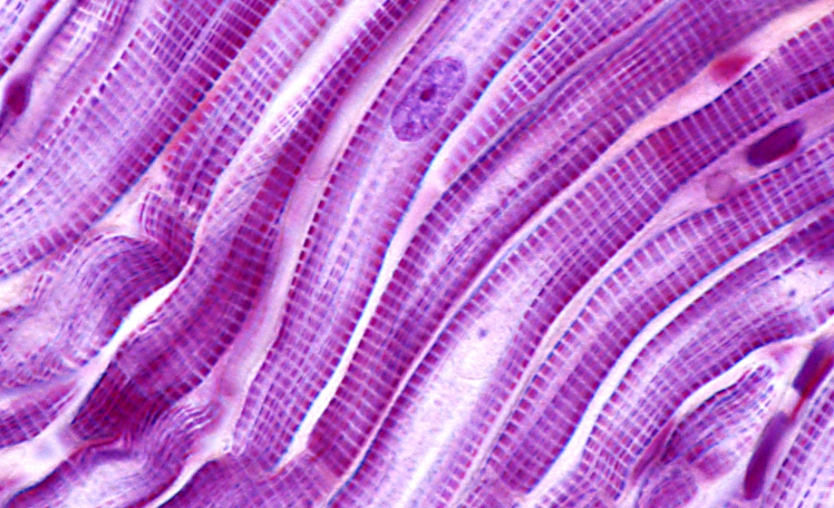 Cut and Paste of Myosin Binding Protein-C in Striated Muscles