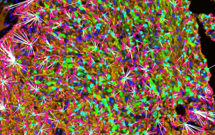Exploring Predictive Biomarkers and ERK1/2 Phosphorylation: A New Horizon in Forecasting Survival and Response to Immune Checkpoint Blockade in Glioblastoma Treatment