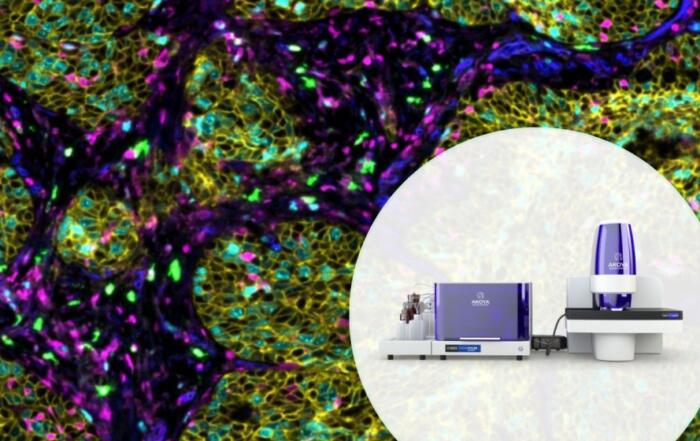 Spatial Phenotyping: A Revolutionary Approach to Biomarker Discovery for Cancer Immunotherapy
