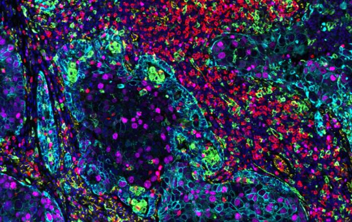 Unlocking Spatial Insights: Accelerate Discoveries 70% Faster with SignalStar™ Multiplex IHC