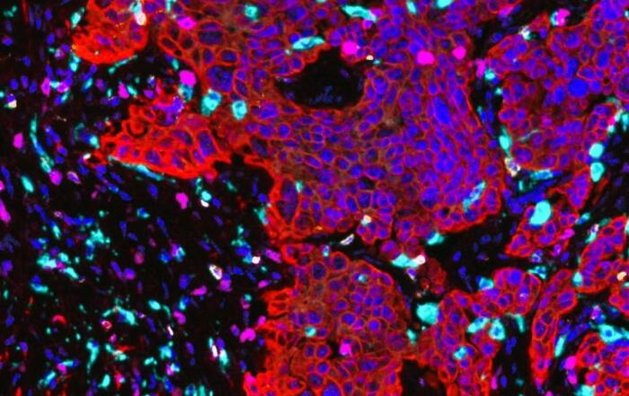 A Ready-to-Analyze High-Plex Spatial Signature Development Workflow for Cancer Immunotherapy