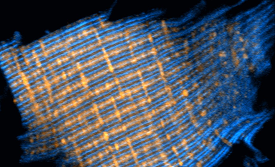 Understanding Advanced Cardiac Tissue Slice Applications