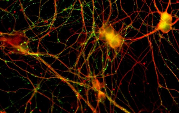 Advancing Disease Modeling for Drug Discovery by Modulating iPSCs with CRISPR and Neuronal Differentiation