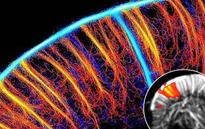 Functional Ultrasound Neuroimaging: Principles, Applications, & Perspectives