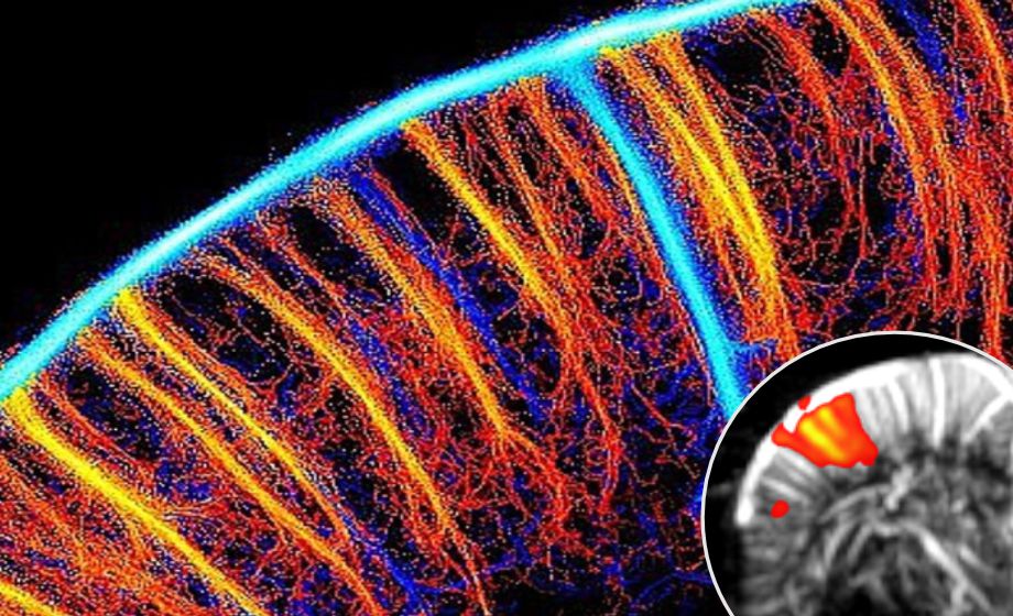 Functional Ultrasound Neuroimaging: Principles, Applications, & Perspectives