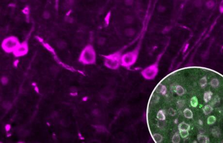 Spatiotemporal Dynamics of Calcium and Neurotransmitters in Awake Mouse Models of Epilepsy