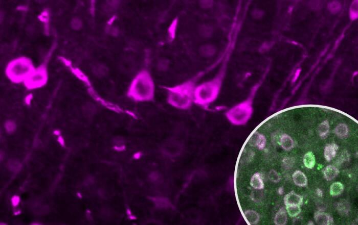 Spatiotemporal Dynamics of Calcium and Neurotransmitters in Awake Mouse Models of Epilepsy