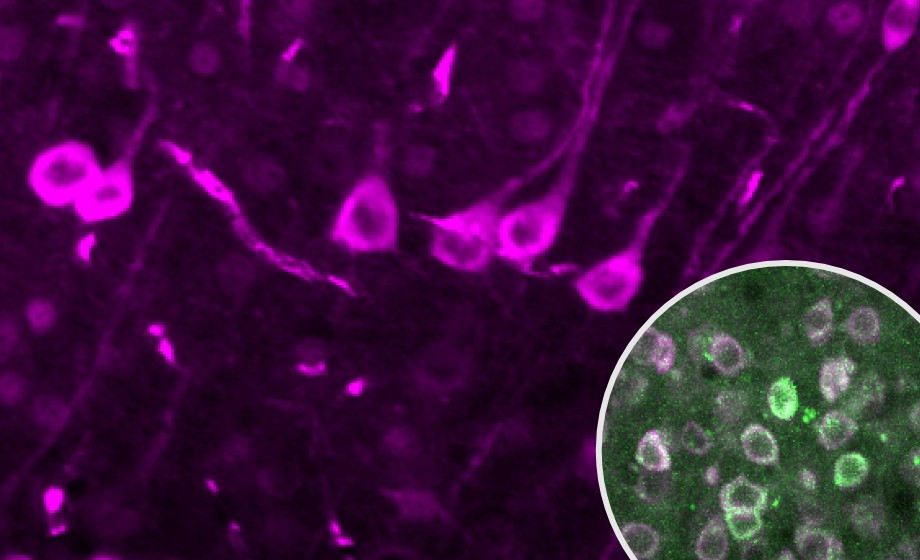 Spatiotemporal Dynamics of Calcium and Neurotransmitters in Awake Mouse Models of Epilepsy
