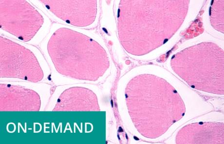 Molecular Signals Mediating Increases in Muscle Size and Function