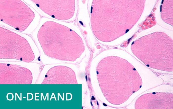 Molecular Signals Mediating Increases in Muscle Size and Function