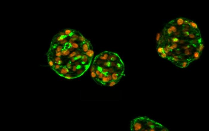 Innovative Approaches to Assessing Thyroid Disruption: The 3D Human Thyroid Microtissue Model