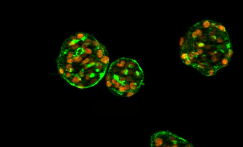 Innovative Approaches to Assessing Thyroid Disruption: The 3D Human Thyroid Microtissue Model
