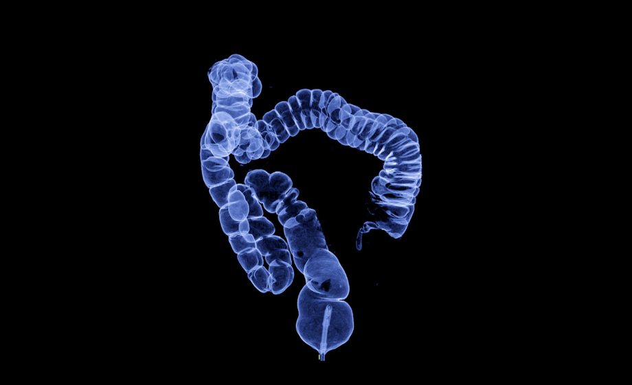CT colonography , This imaging technique is often employed for colorectal cancer screening, providing detailed images of the colon's interior 3D rendering.