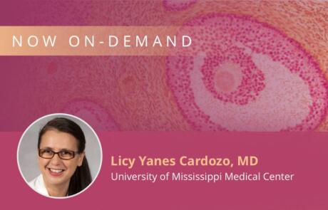Polycystic Ovarian Syndrome and Cardiovascular Disease