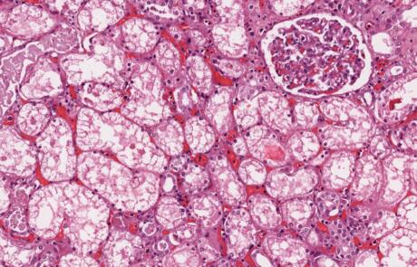 Illuminating Immunohistochemistry: From Biomarker to Clinical Trial Assay
