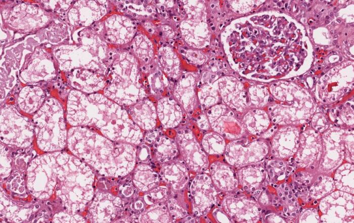 Illuminating Immunohistochemistry: From Biomarker to Clinical Trial Assay