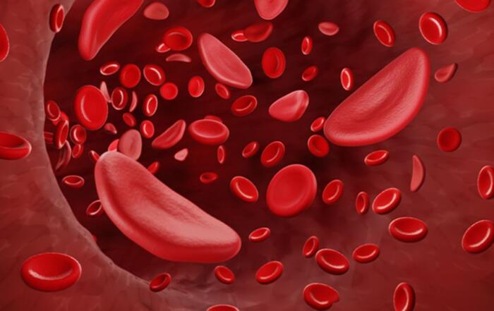 Hematopoietic Stem Cell Fitness and Function During Sickle Cell Disease