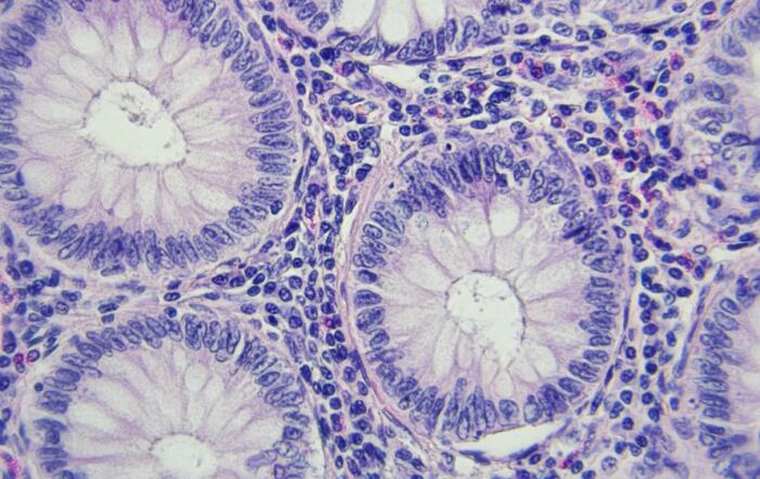 Illuminating Immunohistochemistry: Right-sizing Your Validation and Regulatory Strategy