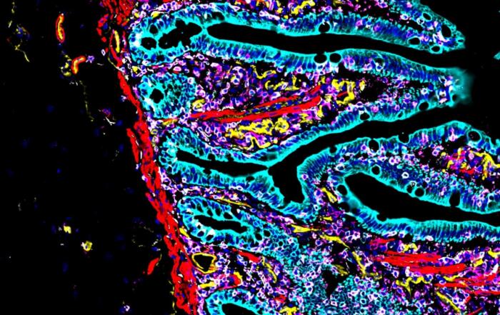 Spatial Biology and the Gastrointestinal Tract: Unveiling Cellular Landscapes and Disease Mechanisms
