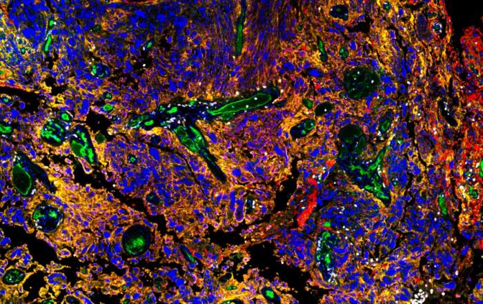 Reprogramming the Brain Tumor Microenvironment to Enhance Anti-Tumor Immunity