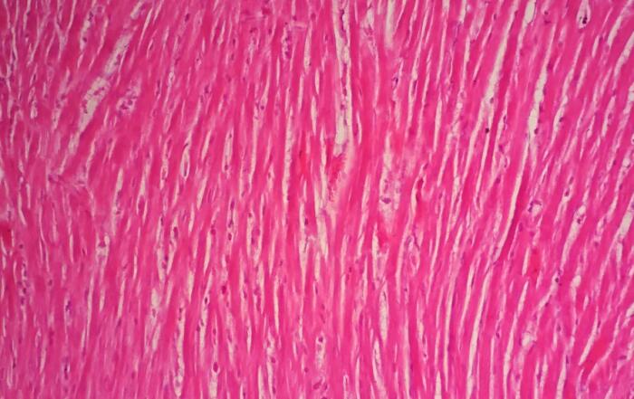 Mimicking the Ventricular Pressure-Volume Relationship Ex Vivo with Cardiac Slices