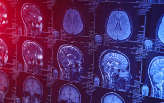 MRI or magnetic resonance imaging of the head and brain. Close up